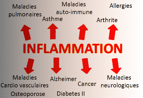 Illustration de l'inflammation